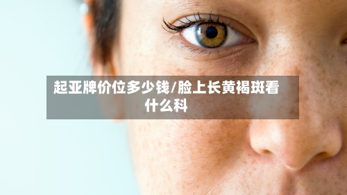 起亚牌价位多少钱/脸上长黄褐斑看什么科-第2张图片
